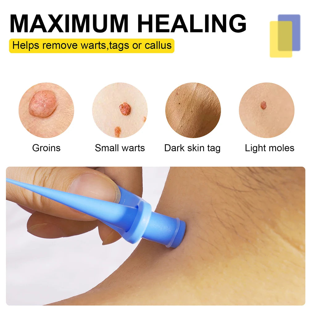 Double-Sided Wart & Skin Tag Remover Tool