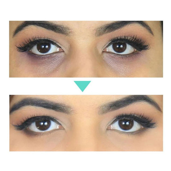 Anti-Aging Skin Care in Skin Care