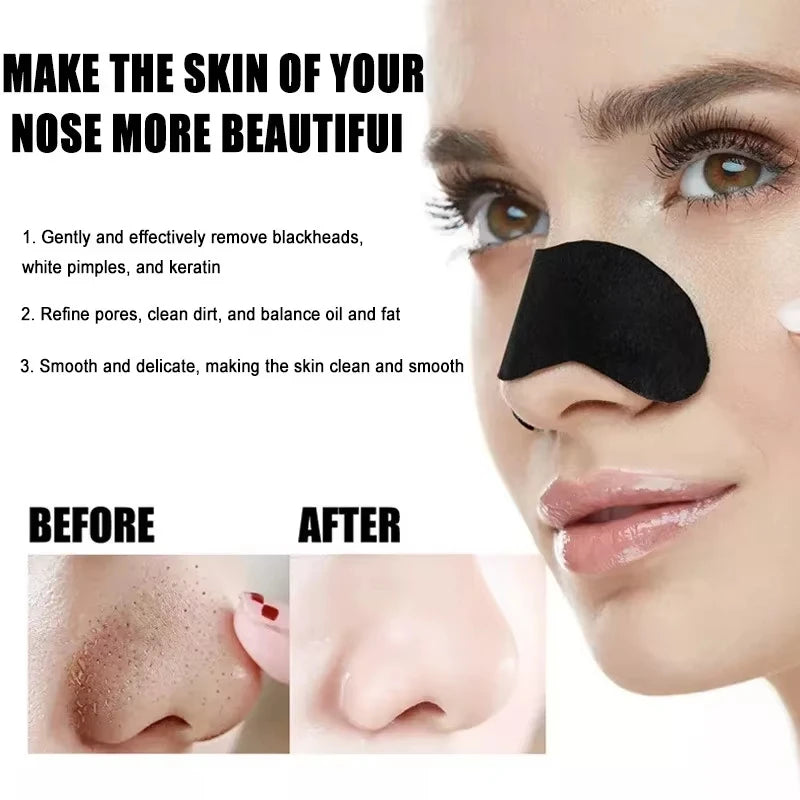 10/50/100PCS Facial Blackhead Removal Stickers – Deep Cleansing & Pore Care