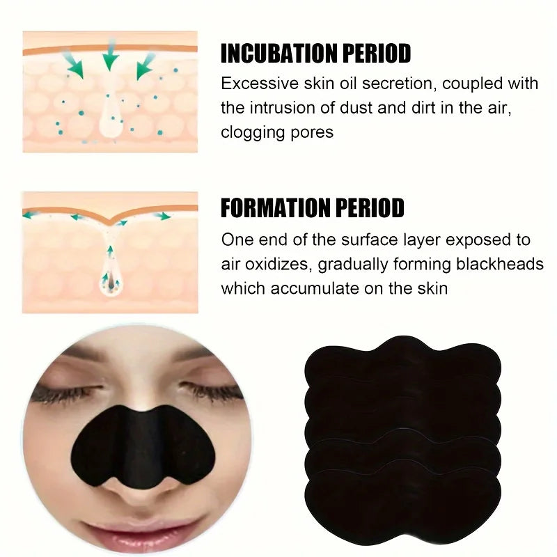 10/50/100PCS Facial Blackhead Removal Stickers – Deep Cleansing & Pore Care