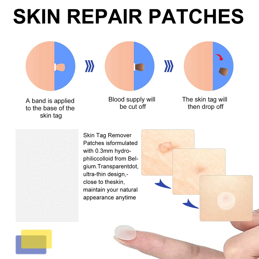 Double-Sided Wart & Skin Tag Remover Tool