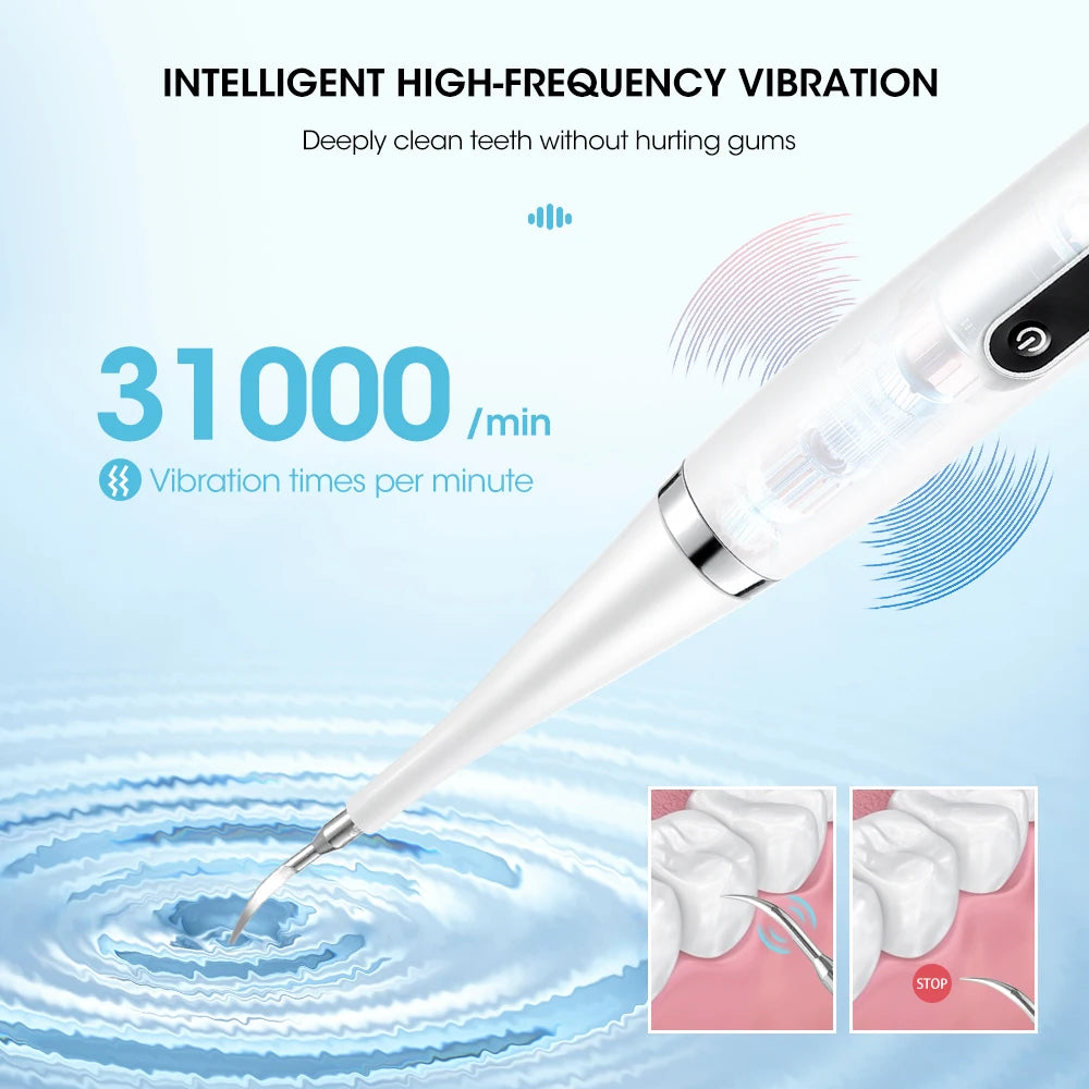 Ultrasound Electric Toothbrush - USB Waterproof, Multi-Function Oral Care