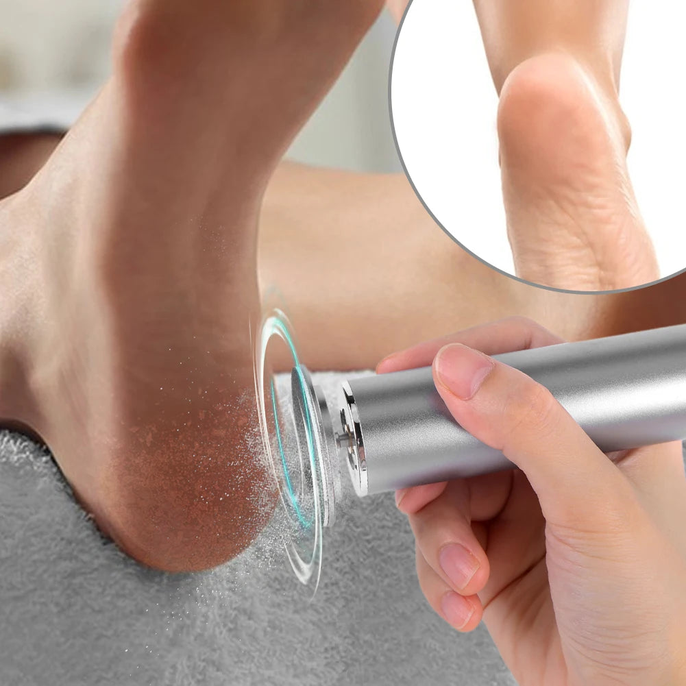 Electric Pedicure Tool - Foot Care & Callus Remover