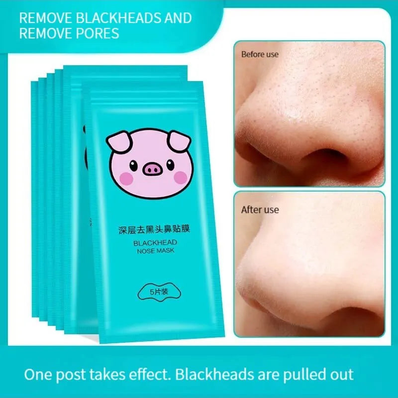 5PCS Blackhead Removal Nasal Strips – Deep Cleansing & Pore Care